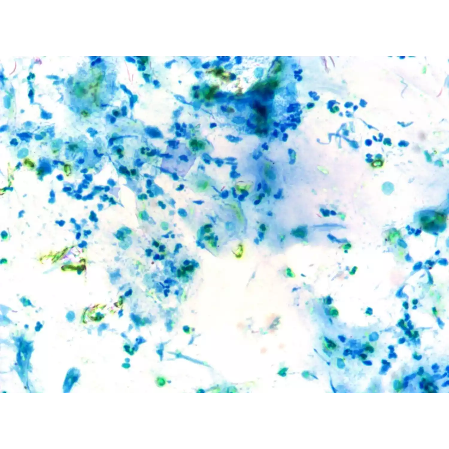 Микроскоп тринокулярный Микромед 3 вар. 3-20М - 3