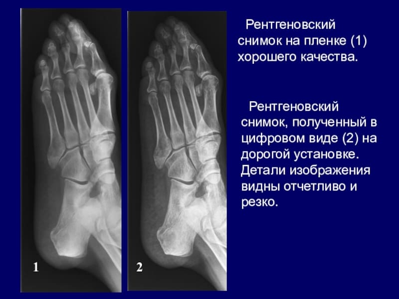 Какой рентген делают. Качество рентгенограммы. Качество снимка рентгенограммы. Качество рентген снимков. Качества рентгенологических снимков.