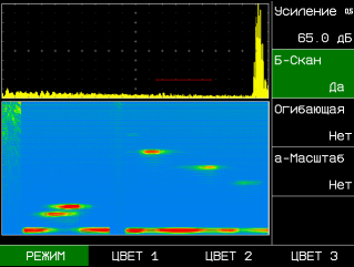 Режим Б-скан